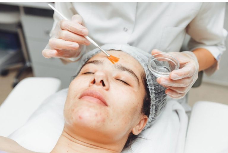 Chemical Peels vs Microneedling – Which Skin Rejuvenation Method is Right for You?