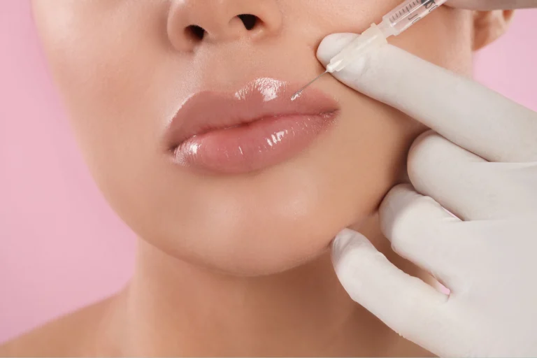 The Rise of Lip Fillers: Exploring the Trend, Benefits, and Considerations