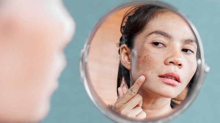 Comprehensive Guide to Effective Pigmentation Treatments for Clearer, Brighter Skin