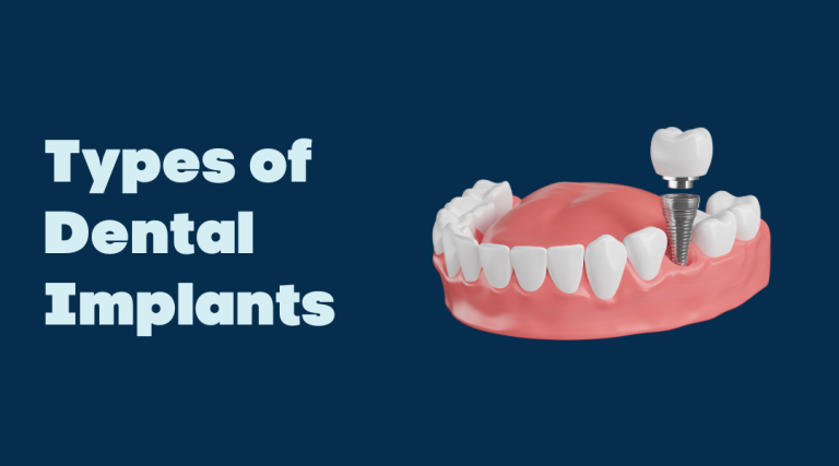 5 Different Types of Dental Implants: A Comprehensive Guide – Kidsgrove Dental & Implant Centre | Dentist Stoke-on-Trent